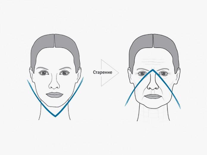 4 эффективных способа избавления от «бульдожьих» щечек