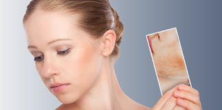 Что такое крапивница и как правильно ее лечить? https://www.skintolivein.ru/