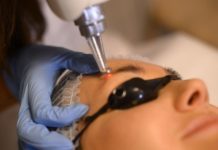 Удаление татуажа на лице удаление татуажа