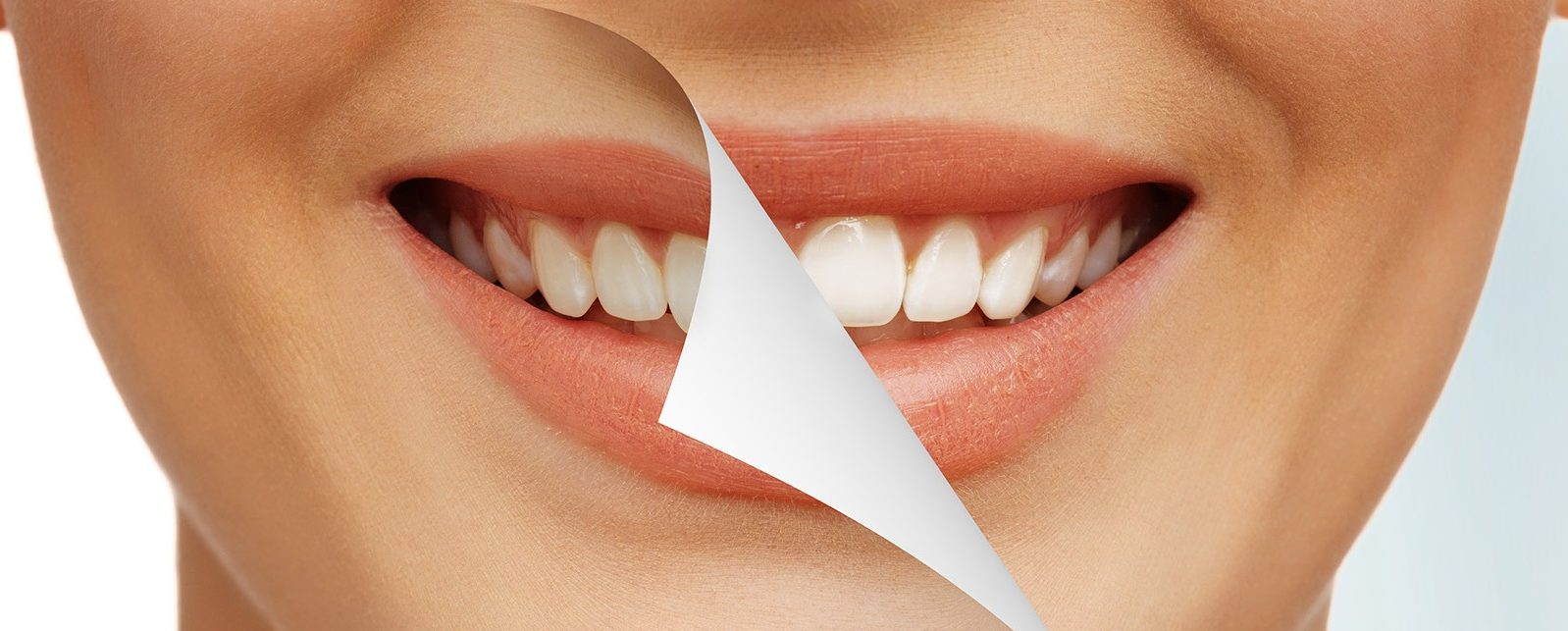 Безопасна ли процедура отбеливания зубов?