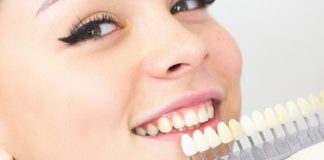 Люминиры для зубов в Ярославле Люминиры для зубов в Ярославле