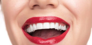 Виниры для зубов — лучшее решение скрыть изъяны! Виниры для зубов - лучшее решение скрыть изъяны!