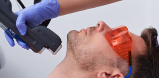 Лазерная эпиляция для мужчин Лазерная эпиляция для мужчин