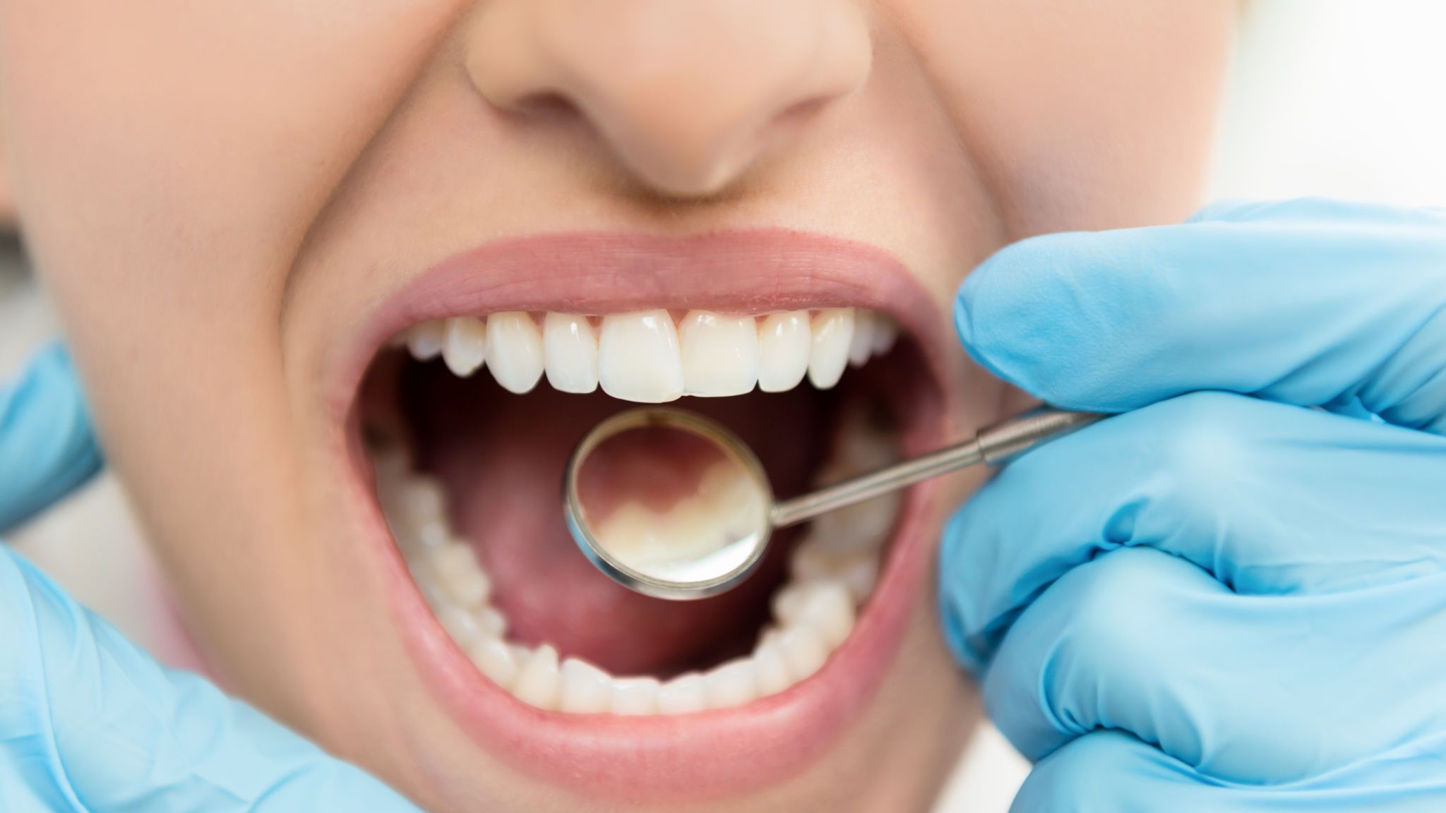 Как заботиться об зубной эмали?