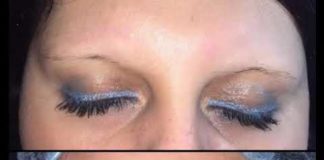 Неудачный татуаж бровей: что делать, как можно перекрыть старый татуаж