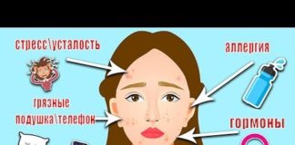 Прыщи между бровями — причина у женщин: почему появляются на переносице и лбу