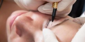 Лазерная эпиляция бровей: описание и основные правила процедуры