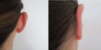 Форма ушей и характер человека