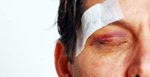 Лечение рассечения лица, первая помощь и препараты для заживления рассечения брови, губы, века и подбородка