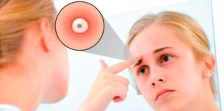 Приметы: прыщ между бровей, на левой или правой брови — Эзотерический журнал