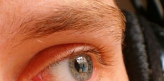 Почему потеют брови и лоб: постоянно, у взрослого, причины, во сне