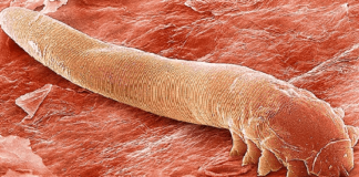 Ресничный клещ или демодекс глаз (век): симптомы и лечение