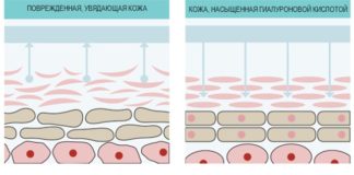 Морщина между бровями