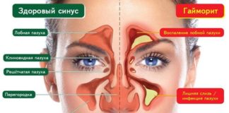 Болит бровь над глазом при нажатии: причины, лечение