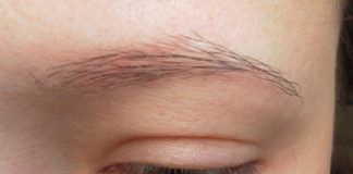 Редкие брови: что делать и почему редеют брови у женщин