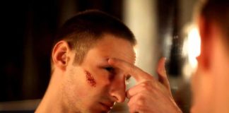 Шишка на брови после удара чем лечить, Обширная информация о здоровье человека