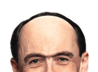 Сросшиеся брови: почему срастаются и как избавиться от них