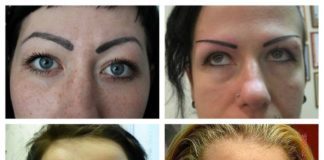 Неудачный татуаж бровей — фото до и после, как исправить