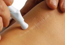 Устранение кожных рубцов Устранение кожных рубцов