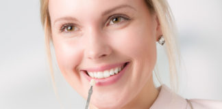 Как ставят виниры: этапы, особенности выбора