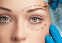Блефаропластика. Суть процедуры, показания и плюсы