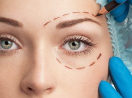 Блефаропластика. Суть процедуры, показания и плюсы