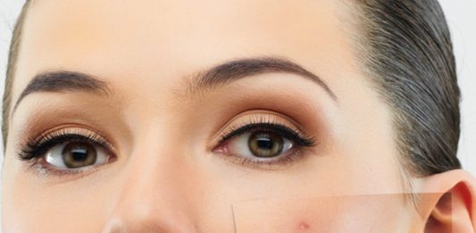 Причины появления прыщей и советы по профилактике