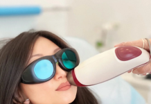 Лазерная эпиляция лица в СПб: подробности