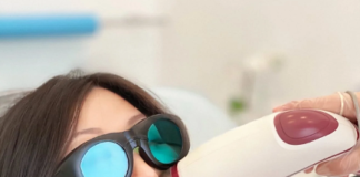 Лазерная эпиляция лица в СПб: подробности