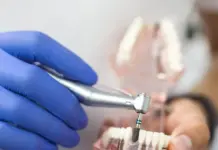 Чистка и гигиена: как ухаживать за керамическими брекетами, чтобы избежать осложнений