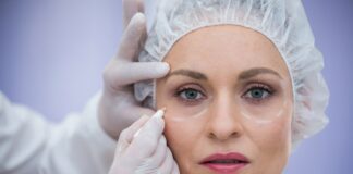 Как проходит блефаропластика