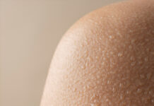 Приём врача-дерматолога: подробное руководство о том, как проходит консультация, какие методы диагностики применяются и почему регулярный осмотр кожи важен для здоровья