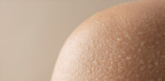 Приём врача-дерматолога: подробное руководство о том, как проходит консультация, какие методы диагностики применяются и почему регулярный осмотр кожи важен для здоровья