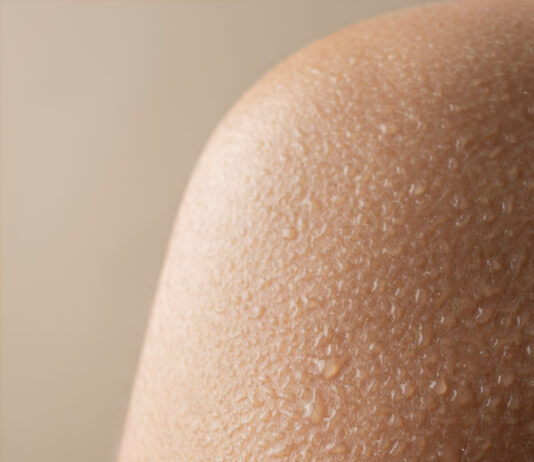 Приём врача-дерматолога: подробное руководство о том, как проходит консультация, какие методы диагностики применяются и почему регулярный осмотр кожи важен для здоровья